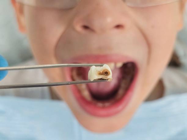 Best Emergency Root Canal Treatment in Wewa, OK
