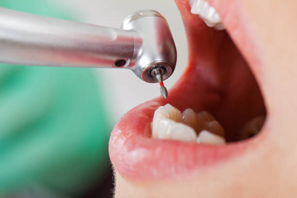 Best Emergency Dental Care for Abscessed Tooth in Wewa, OK